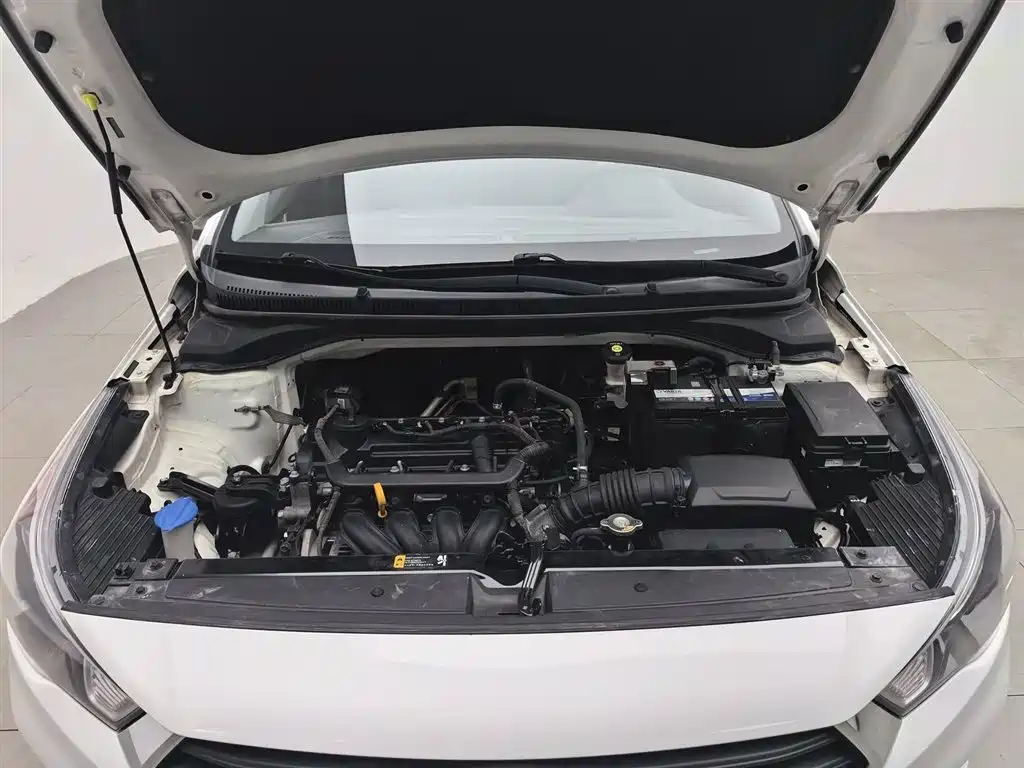 Hyundai Verna 2017 — фото 6
