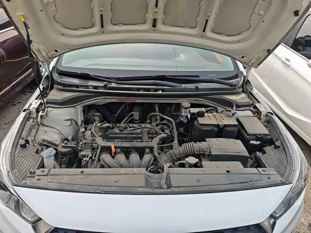 Hyundai Verna RV 2018 — фото 16