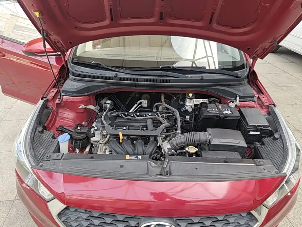 Hyundai Verna RV 2018 — фото 20
